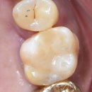 비욘드치과기공소 이미지