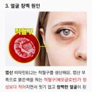 엽산의 효능 6가지 이미지