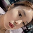 에바가골든사우나(피부관리실) | 대구달서구피부관리 나노mts 후기 (mts 뜻, 엑소좀 스킨부스터 효과, mts 후관리법)