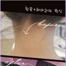권헤어라인