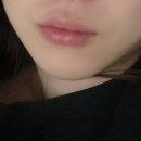 강남구청 | 강남구청 입술필러 후기 내돈내산 만족 리뷰