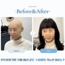 인모항암가발 진짜 머리 같은 스타일링 가능한 이유는