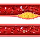 청혈한의원 이미지
