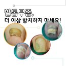 클린앤뷰티의원 | 부산 발톱무좀 치료는 경성대 클린 앤 뷰티 의원에서!