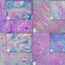 지중해 양식 홍민어의 Mycobacterium pseudoshottsii 이미지