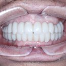 애프터기공소 이미지