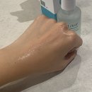 샤넬멍 | 샤넬주사 시술후기 통증 멍 부작용 시술 후 관리
