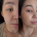 브이케어 | 마미 케어 EMS 브이 쎄라 사용 후기
