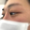 아이라이크(EYE LIKE) 이미지