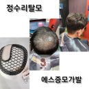 가발 소매업 - 119 | 원조전문가 S증모가발