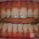 예스해피 치과기공소 이미지