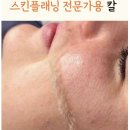 엔코라인 | [내돈내산] 다이소 눈썹칼 쓰리고 아팠다면? 엔코슈 스킨플래닝 눈썹칼 추천, 4주사용 만족!