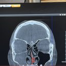 연세고른숨이비인후과의원 이미지