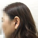 조현이비인후과 네이버블로그