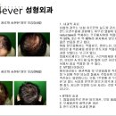 4ever성형외과 네이버블로그