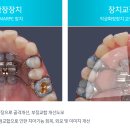 마르페marpe