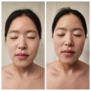 대구 대봉동 웨딩거리 윤곽관리 웨딩관리 라보떼뷰티 윤곽피부관리 솔직후기