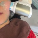 다산2 | 남양주 다산 피부과 리니어지 리프팅 후기(가격/효과)