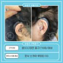 삼성생명맞은편(포낙보청기 앞) | 정부지원보청기,문XX고객님 포낙 스카이 루미티 50 구매후기(70대,女)