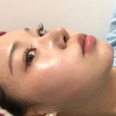 서현 스킨앤바디 | 대전피부관리 서현스킨앤바디 좁쌀진정 모공청소 후기
