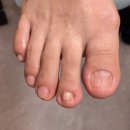 레푸스미아 | 미아동발톱무좀 엄마 효도관리 후기 레푸스 미아점