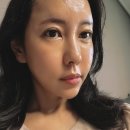 엑소좀 스킨부스터 | 수원피부과 인에이블 mts 후기 및 효과