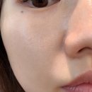 대**** | 대구리투오 후기, 모공 때문에 받았는데 피부결까지 만족했던 솔직후기
