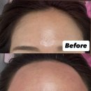 한빛공원(리더스프라자 앞) | 화명동왁싱은 노아뷰티에서 웨딩촬영 전 왁싱 첫 후기 페이스왁싱, 헤어라인왁싱 해도 될까요?