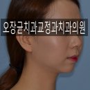 오장균치과교정과치과의원 네이버블로그