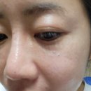 도심속수산 | 수분진정 나인세럼 후기♡"