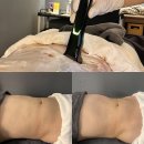 제이에스(JS)바이오 | 검단피부관리 당하동피부관리 써마젯 고주파 복부관리 제이에스JS에스테틱 후기