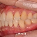 GM치과 이미지