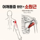 어깨 통증의 숨은 원인, 소원근입니다 임상에서 반드시 확인해야 할 회전근개 이미지