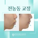 정도 유도 체육관 | 전농동 교정 하나로 성형없이 옆모습 라인 달라진 후기