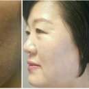 인셀덤경기 이미지