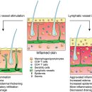 Regulation of Immune Function by the Lymphatic Vasculature 이미지