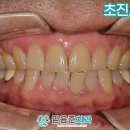 서원동-18 네이버블로그