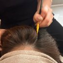 두피 탈모 아미치 0.3 수원점 이미지