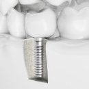 서울나란이치과의원 이미지