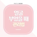 소담 인셀덤