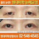 강남현대미학성형외과 Daum카페