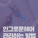 이노헤어(INNO HAIR SALON) | [왁싱 후 관리법] 인그로운 헤어 관리 방법 필독