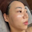 벨루나에스테틱 | 문제성피부관리로 유명한 오송피부관리실 벨루나에스테틱 후기