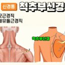 목근육 뭉침 통증의 원인과 예방법 이미지