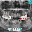 성현동-35 네이버블로그