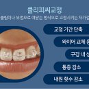 꽃미소치과교정과치과의원 이미지