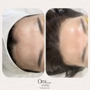 미뉴트디자인 | 월곡왁싱-오미뉴트뷰티 이마 라인, 더 깔끔하게! 월곡역 헤어라인왁싱