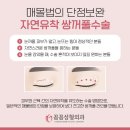 꼼꼼성형외과의원 네이버블로그