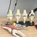 서울나우병원 | [생활정보] 부모님 무릎 인공 관절수술 후기 _서울나우병원 (퇴행성 관절염)