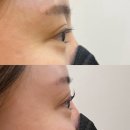 대전속눈썹미수다 | ㅣ 대전속눈썹 미수다 ㅣ 14년 경력 뷰티샵 지속력최고 속눈썹펌 후기